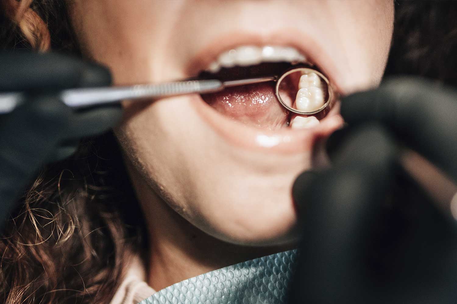 https://dentalike.pe/wp-content/uploads/2018/01/Implantes7.jpg