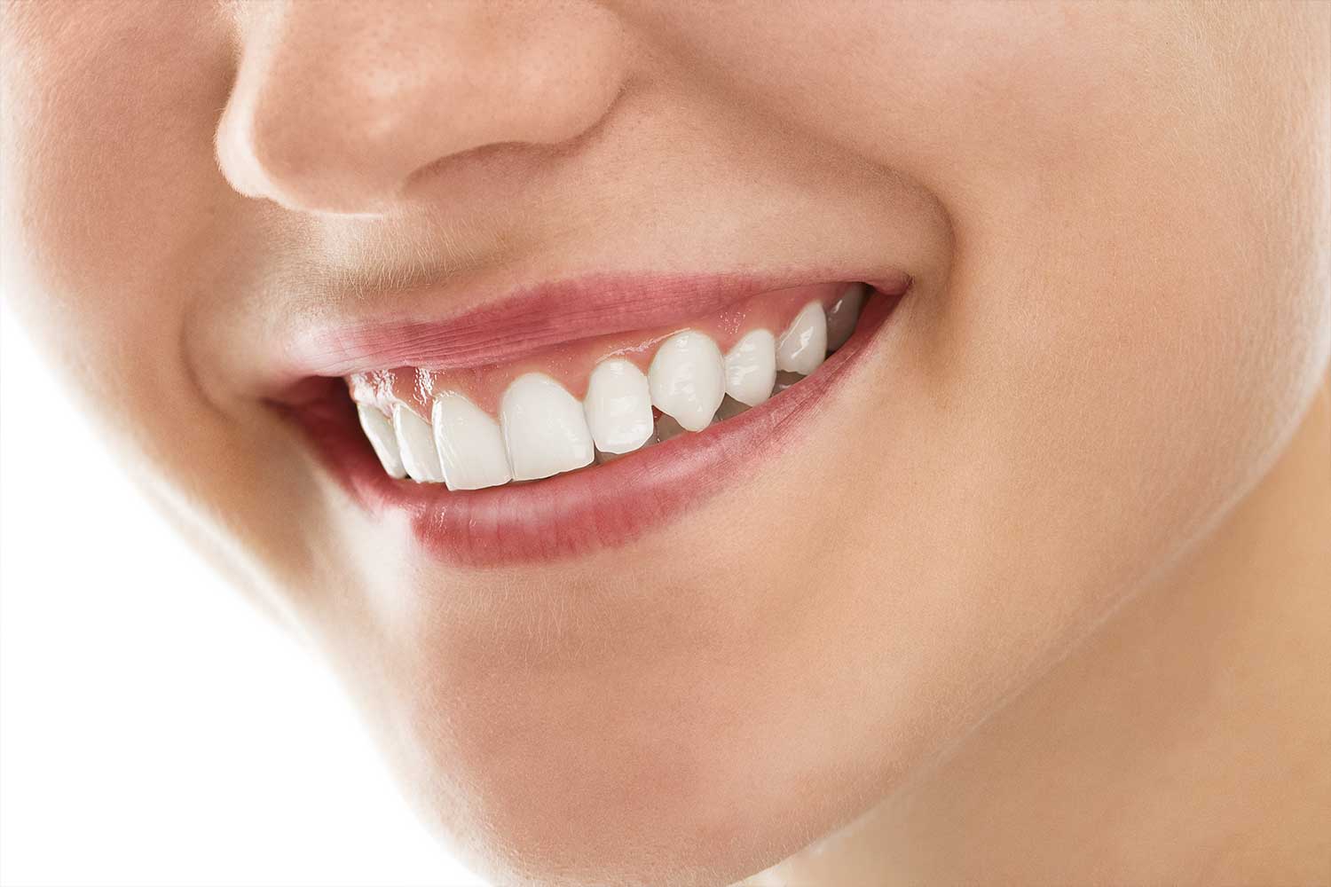 https://dentalike.pe/wp-content/uploads/2020/04/gingivoplastia.jpg