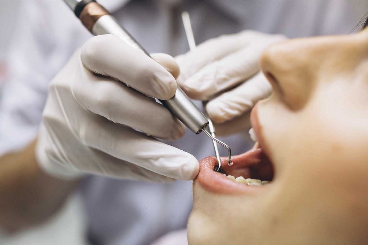reposicionamiento-labial-1200x800.jpg